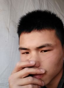 女警称如果脸上不留疤心中会留疤